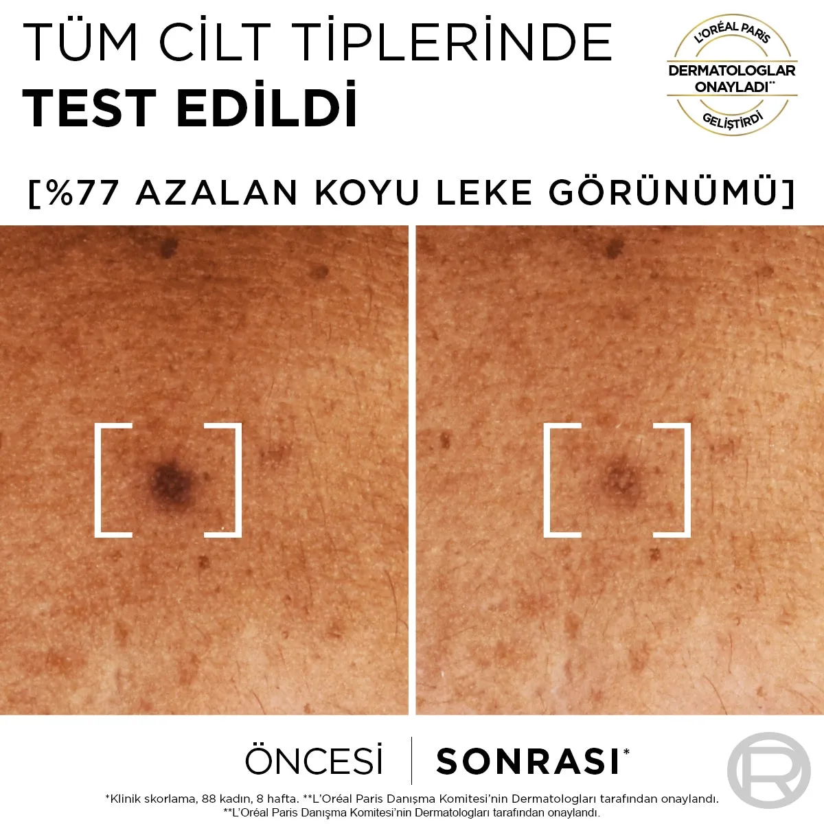 Bright Reveal Sivilce, Güneş, Yaşlanma Lekelerinde Etkili Koyu Leke Karşıtı Serum 10%Niasinamid 30ml